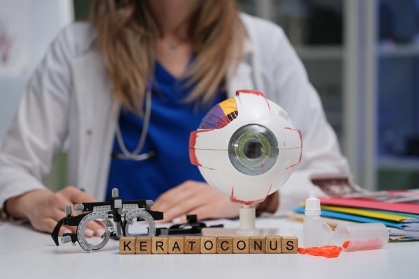 Keratoconus Treatment: When To See An Eye Doctor